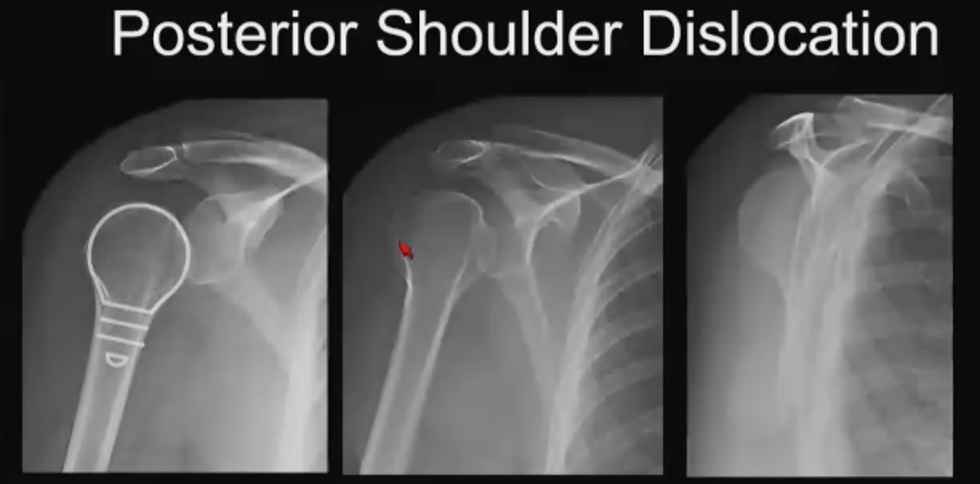 Strategic Radiology Things That Go Bump in the Night Tricky MSK Trauma